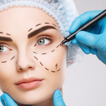Cosmetic-Surgery